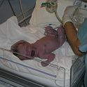 Birth